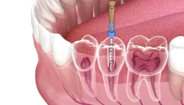 Endodontics